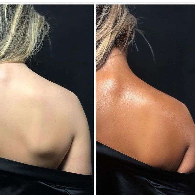 Opalanie natryskowe u osób z jasną karnacją