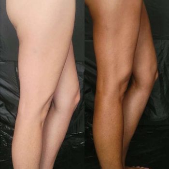 jak schodzi opalenizna